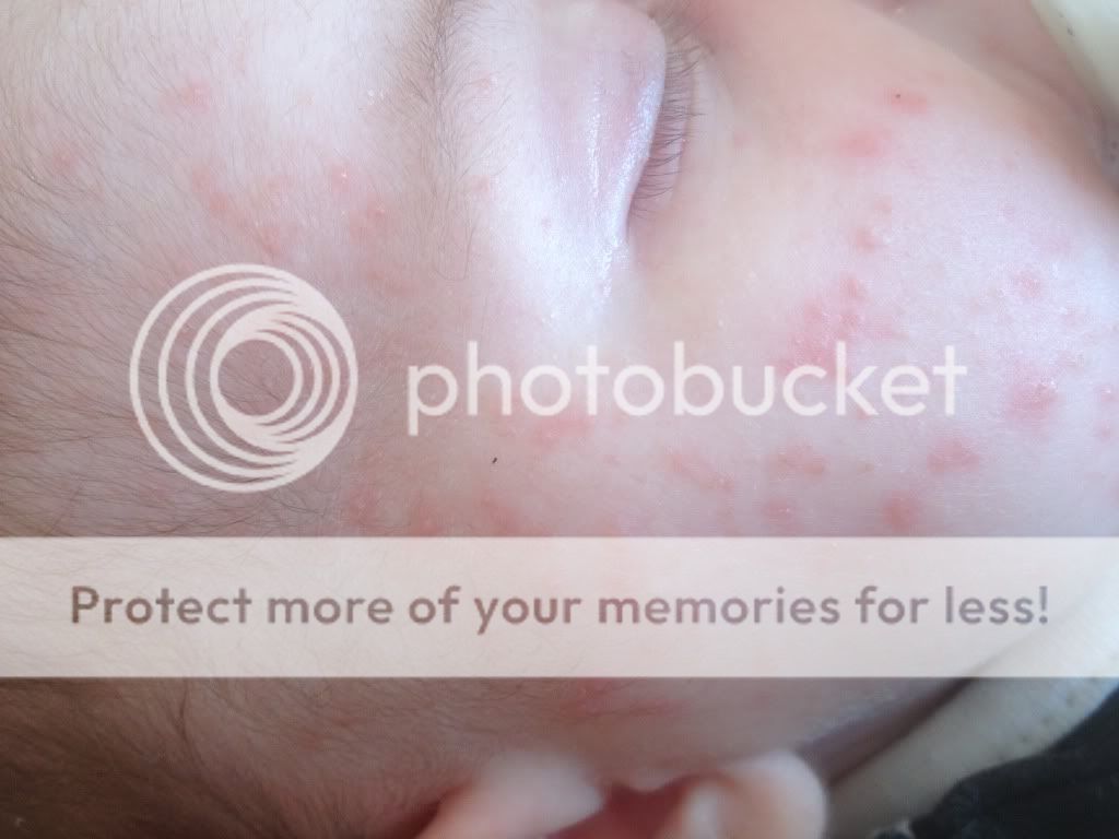 facial-heat-rash-busty-mistress-corporal-punishment